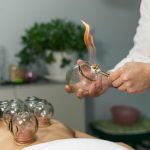 Cupping Therapy for Stress